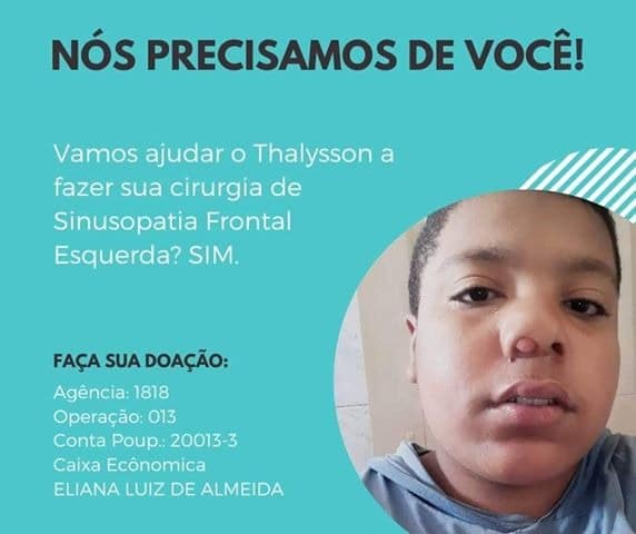 19 06 20 cirurgia thalysson 1