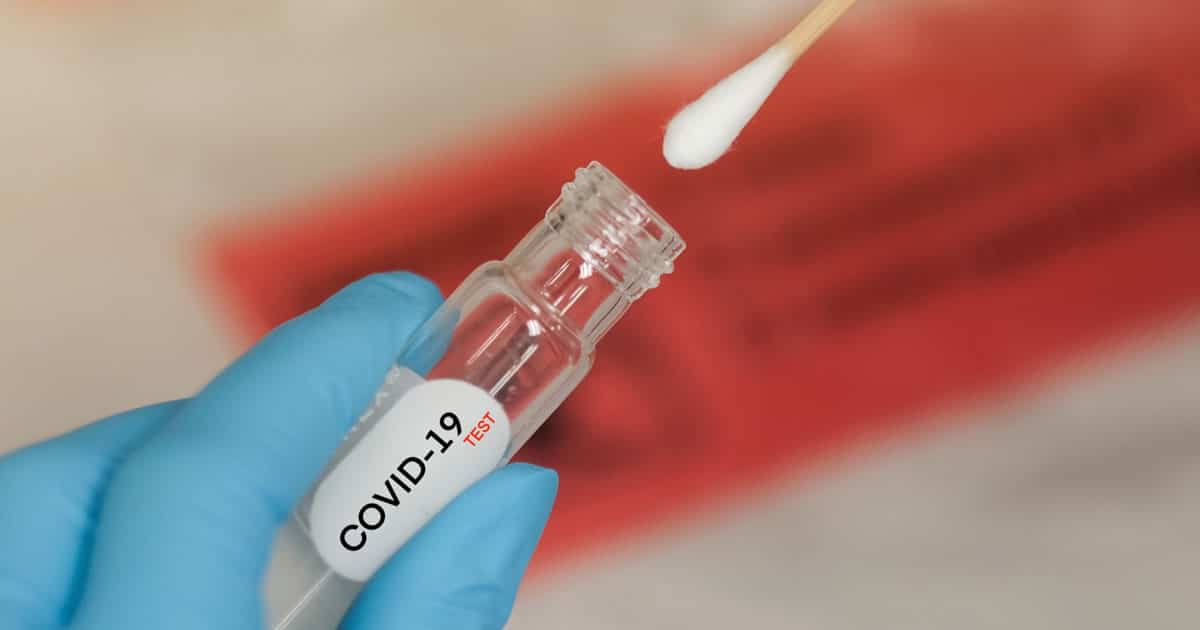 21 08 20 coronavirus teste saliva