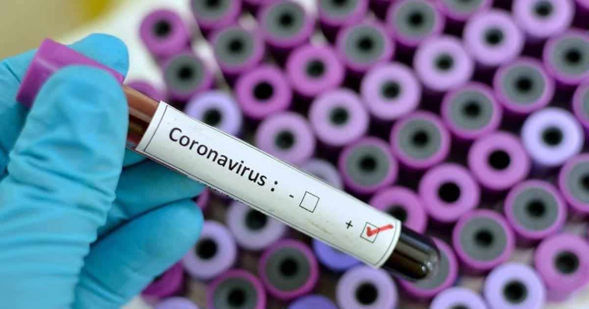 19 10 20 coronavirus em joao pinheiro