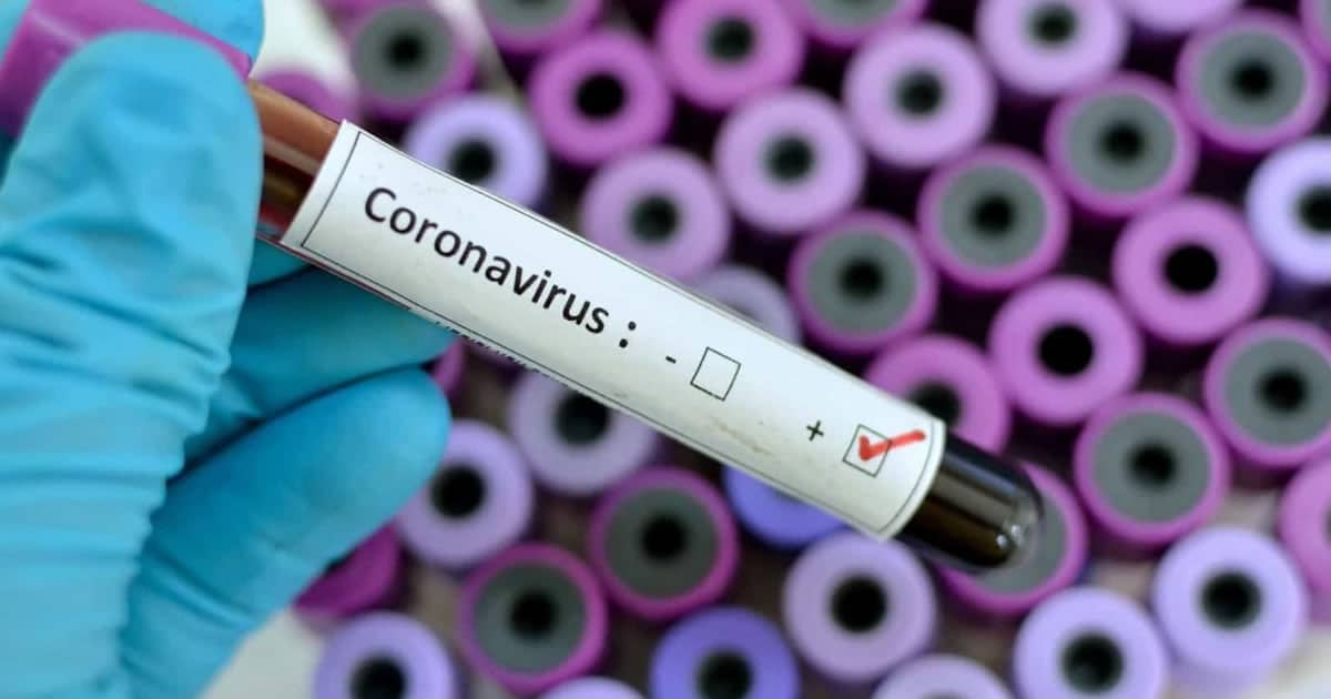 28 10 20 coronavirus em joao pinheiro