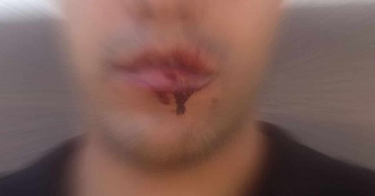 17 11 20 tentativa de homicidio em jk