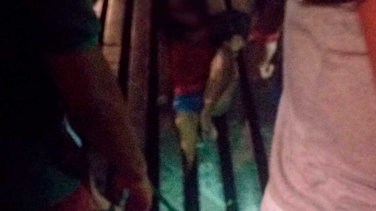 Jovem que ficou com perna presa em bueiro