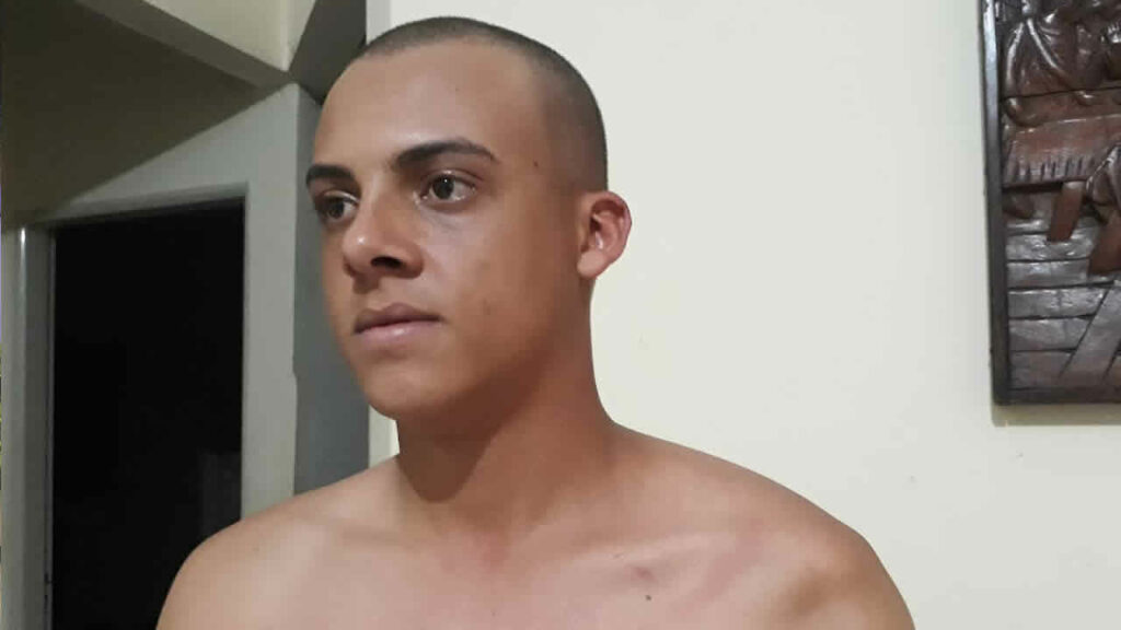 Com risco iminente de perder movimento total do braço, jovem faz apelo por cirurgia em João Pinheiro