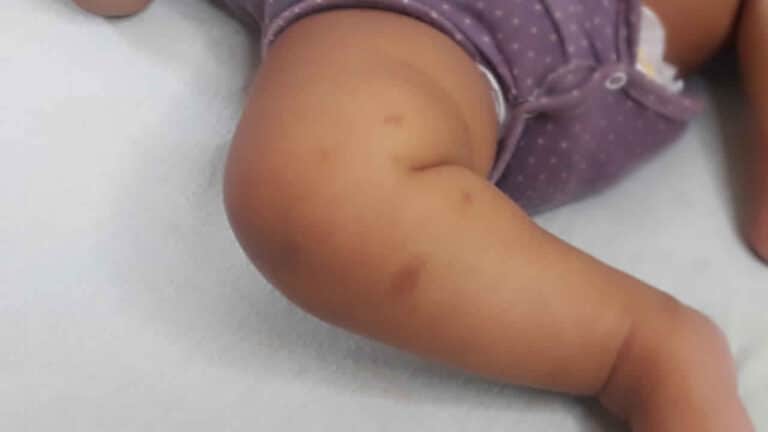 Pinheirenses reclamam da quantidade de mosquitos e pernilongos; cobrança por providências parte de todos os bairros