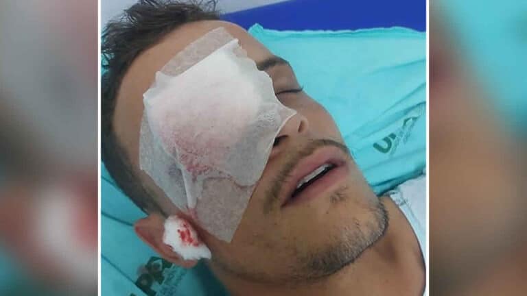 Adolescente não aceita o fim do relacionamento e fura o olho de ex-namorado com uma broca em João Pinheiro