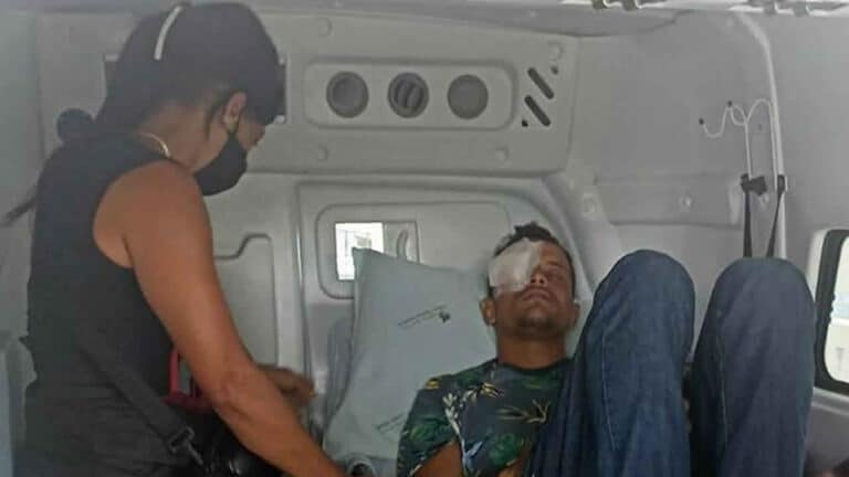 Jovem que foi ferido no olho direito por ex-namorada consegue transferência para Belo Horizonte