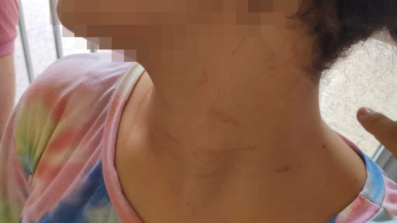 Por ciúmes do ex, mulher agride adolescente de 13 anos nas Lajes, distrito de João Pinheiro