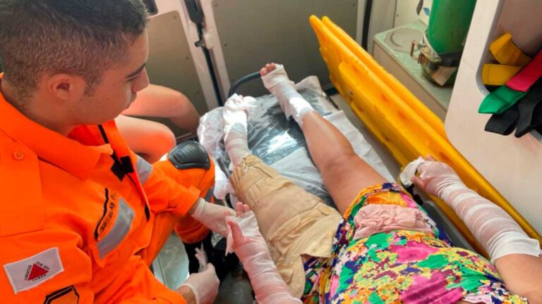 Pinheirense sofre queimaduras de 2º grau ao manusear álcool fazendo sabão caseiro em Canabrava, em João Pinheiro