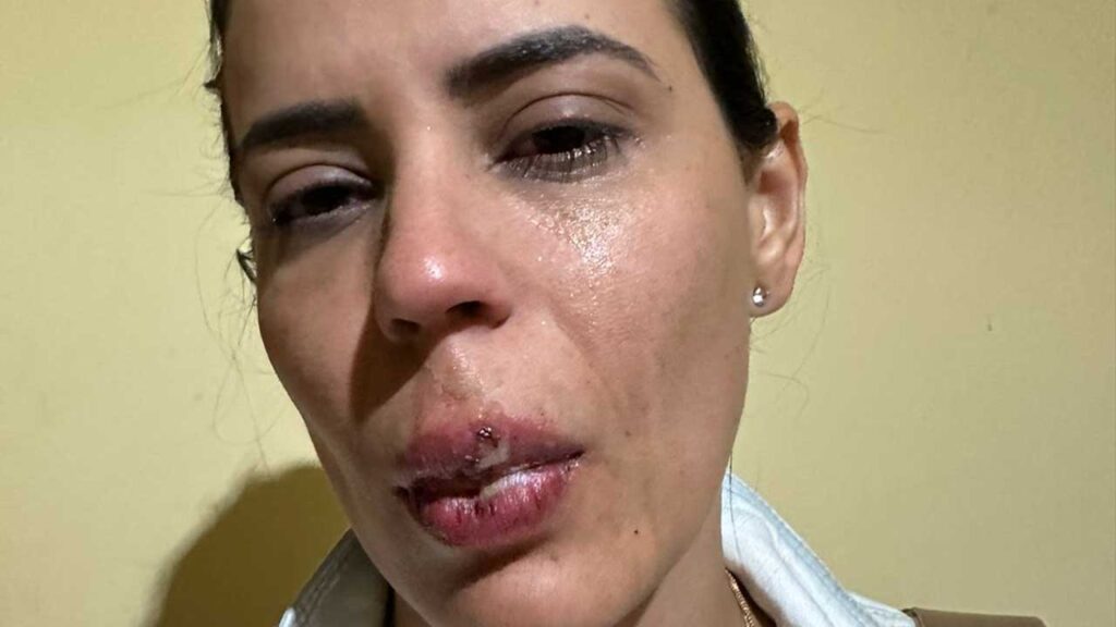 Mulher é vítima de homofobia e agressão durante evento em Brasilândia de Minas