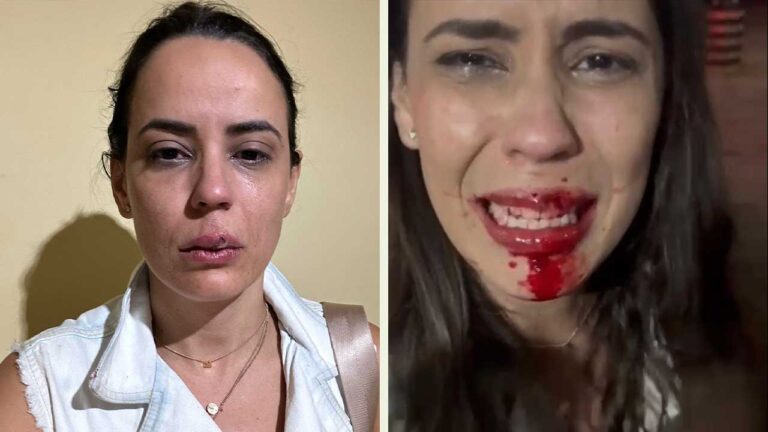 Mulher é vítima de homofobia e agressão durante evento em Brasilândia de Minas