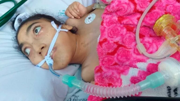 Ajude a Laleska: família inicia nova campanha para adquirir bomba de alimentação em João Pinheiro