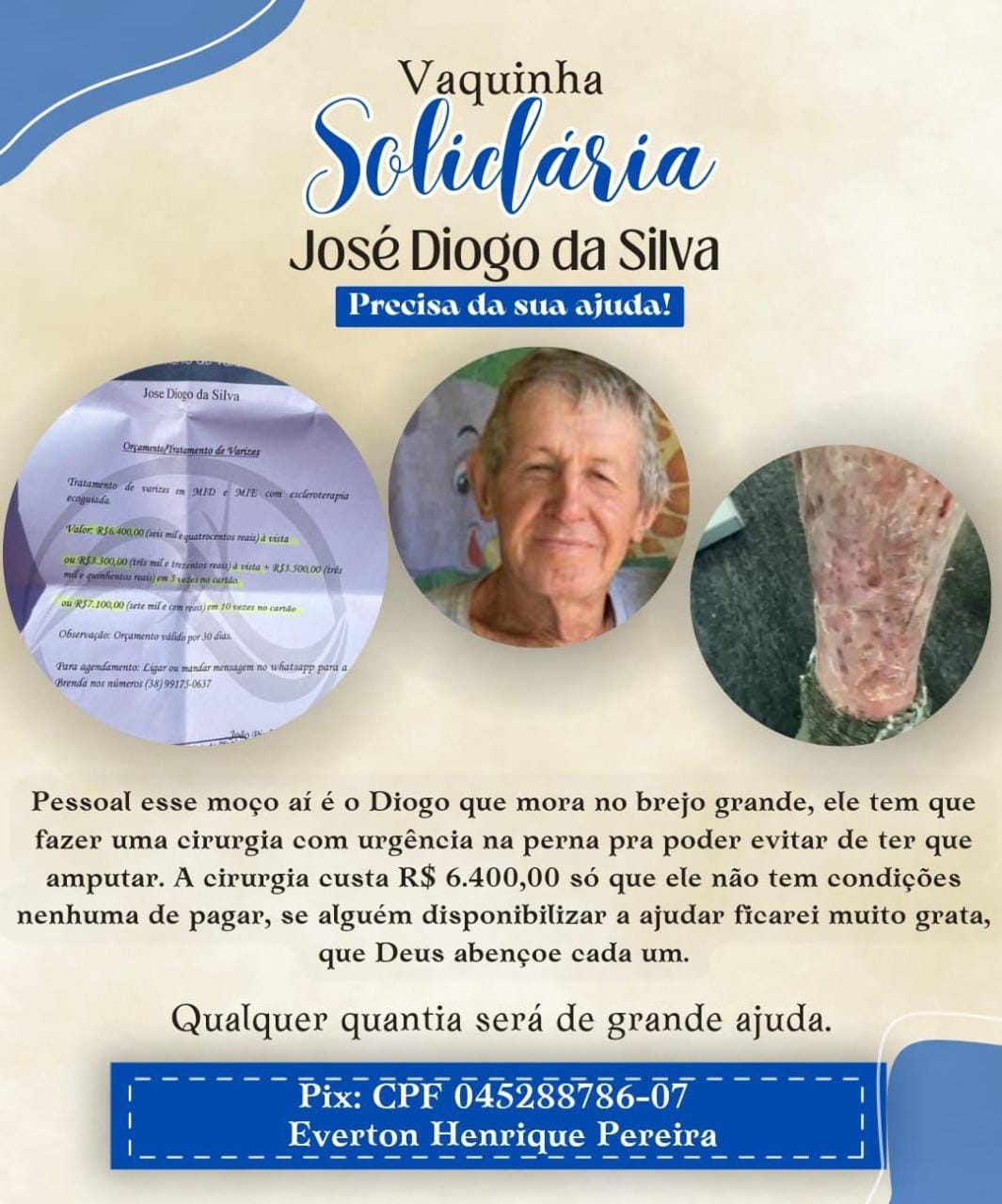 Comunidade cria campanha para ajudar idoso que corre risco de amputar uma das pernas em João Pinheiro