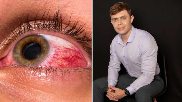 Como agir em emergências oculares? Dr. Diego Bernardo da Clínica Pró Saúde esclarece
