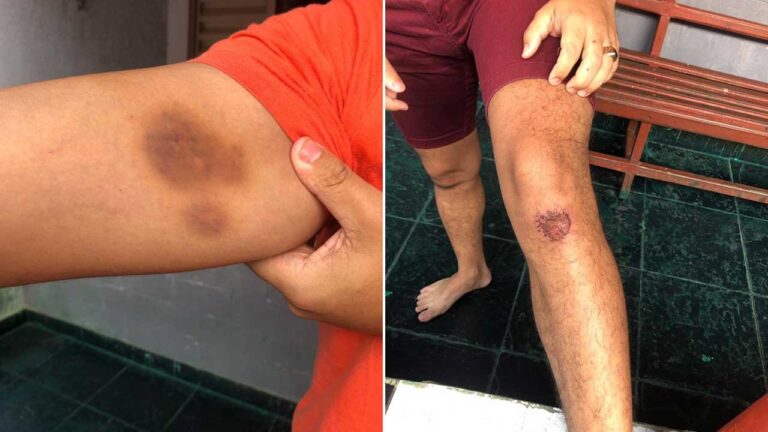 Homem nega ter agredido ex-namorada em Brasilândia de Minas e dá sua versão dos fatos