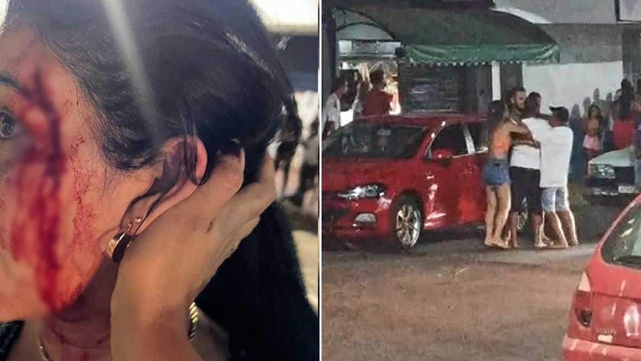 Mulher que foi agredida pela amante do ex-marido recebeu golpe violento de capacete no rosto em Brasilândia
