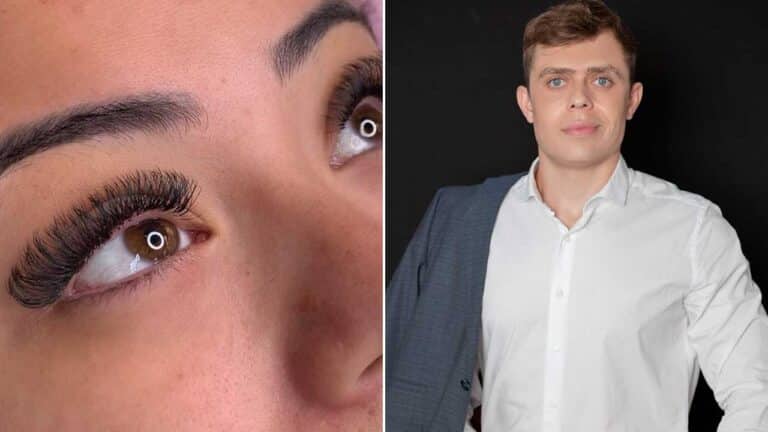 Cuidados essenciais com extensão de cílios: oftalmologista Dr. Diego Bernardo dá orientações em João Pinheiro