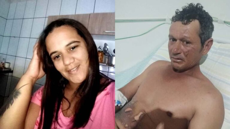 Mulher é suspeita de atear fogo no namorado em Varjão de Minas; homem sofreu queimaduras de segundo grau