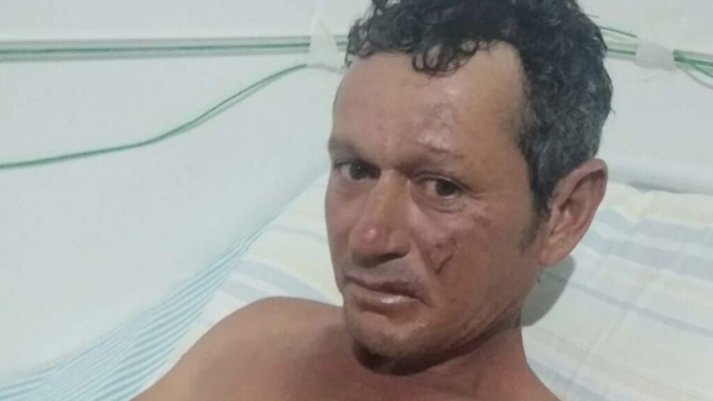 Mulher é suspeita de atear fogo no namorado em Varjão de Minas; homem sofreu queimaduras de segundo grau