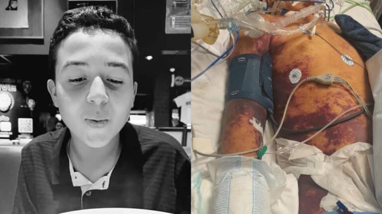 Mãe pinheirense perde filho de 13 anos para bactéria agressiva em hospital do DF e denuncia negligência