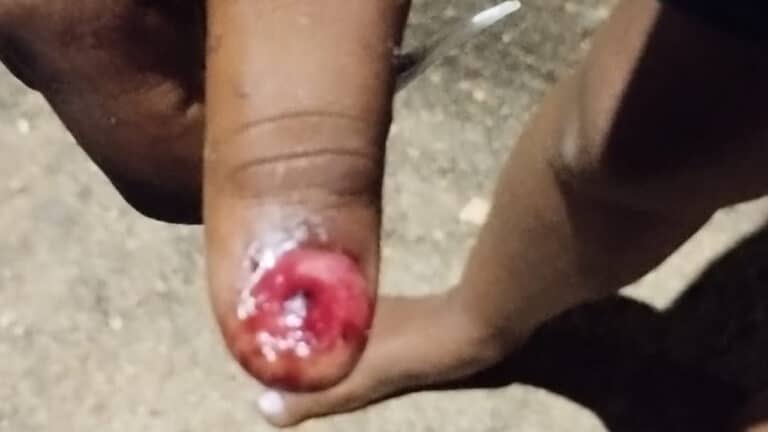 Briga entre cunhadas por fogos de artifício termina em agressões, dedo mordido e prisão por pensão em João Pinheiro