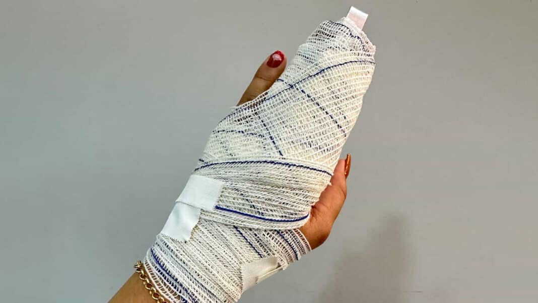 Na raça! Mulher reage a roubo, persegue ladrão, recupera bolsa e ainda quebra o dedo em João Pinheiro
