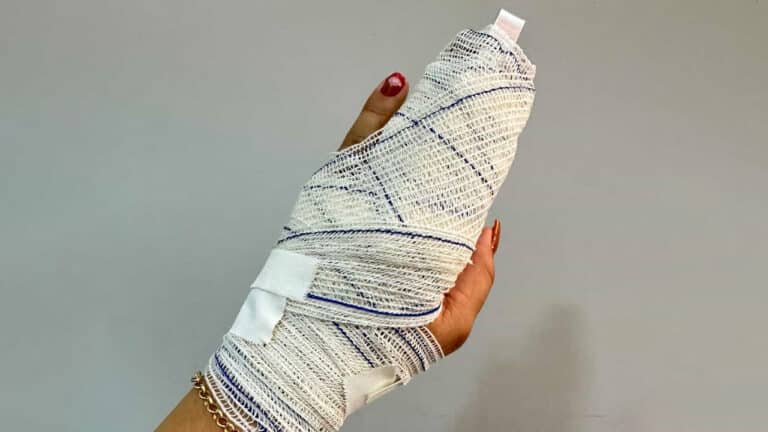 Na raça! Mulher reage a roubo, persegue ladrão, recupera bolsa e ainda quebra o dedo em João Pinheiro