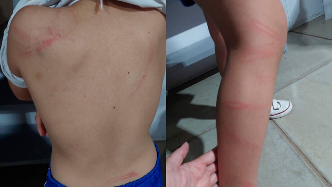 Mãe é presa após agredir filha de 6 anos com mangueira por não conseguir fazer o dever de casa em João Pinheiro