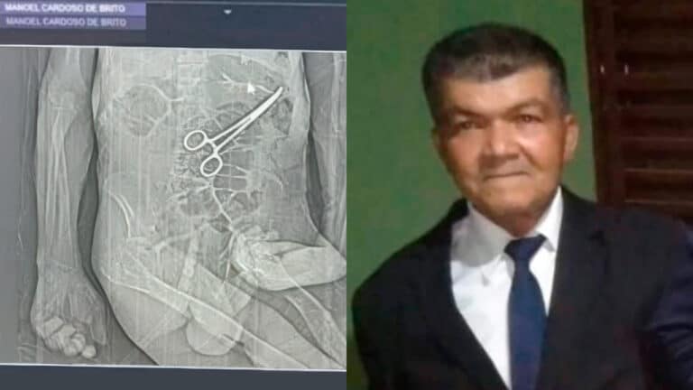 Erro grave! Tomografia indica pinça esquecida em idoso que faleceu no Natal no Hospital Municipal de João Pinheiro
