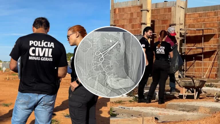 Polícia Civil faz exumação para investigar erro médico após pinça ser esquecida em idoso em João Pinheiro