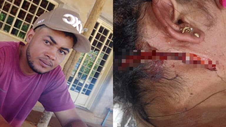 Ataque brutal: mulher é esfaqueada no pescoço pelo ex em Brasilândia e vizinho evita feminicídio