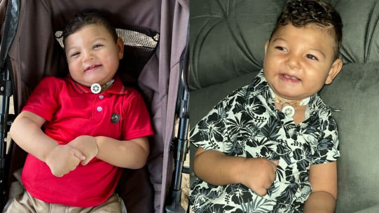 Há 1 ano na fila do SUS, bebê de João Pinheiro precisa de cirurgia urgente e família pede ajuda