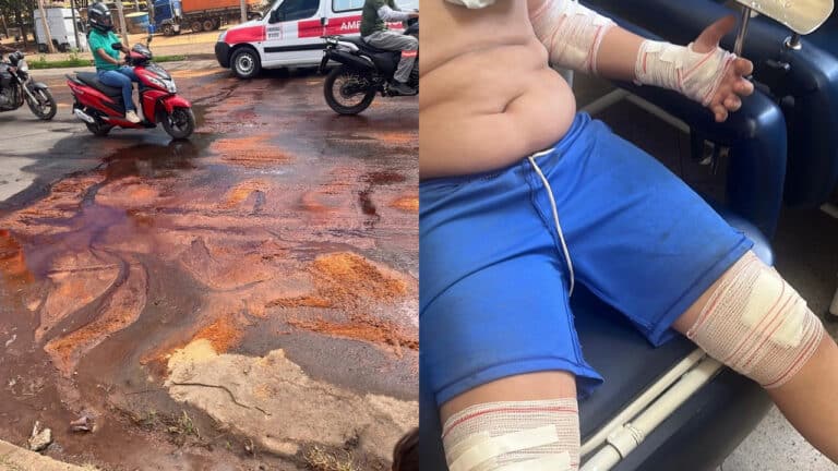 Óleo na pista derruba várias crianças que voltavam da escola próximo ao Posto Trevo 2 em João Pinheiro 