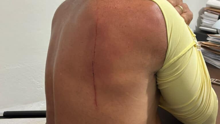Homem é atacado com facão após suposta acusação de xingar esposa de morador no Tauá, em João Pinheiro 