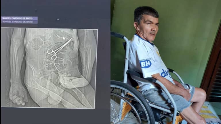 Médicos e instrumentador são indiciados por homicídio culposo na morte de idoso com pinça esquecida em João Pinheiro