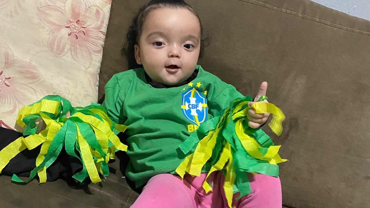 Helena, bebê de 7 meses, precisa de tratamento urgente após diagnóstico de braquicefalia em João Pinheiro