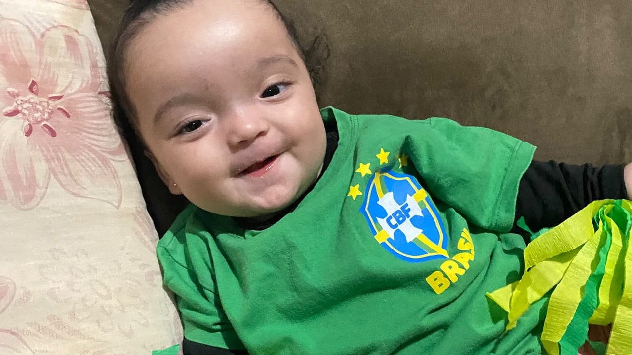 Helena, bebê de 7 meses, precisa de tratamento urgente após diagnóstico de braquicefalia em João Pinheiro