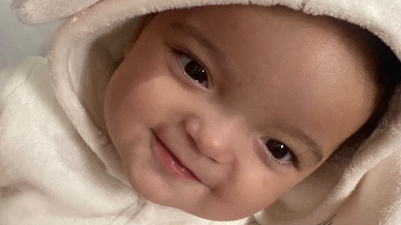 Helena, bebê de 7 meses, precisa de tratamento urgente após diagnóstico de braquicefalia em João Pinheiro