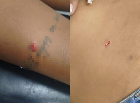 Briga por ciúmes marcada pelo celular termina com duas mulheres esfaqueadas nas Lages, em João Pinheiro