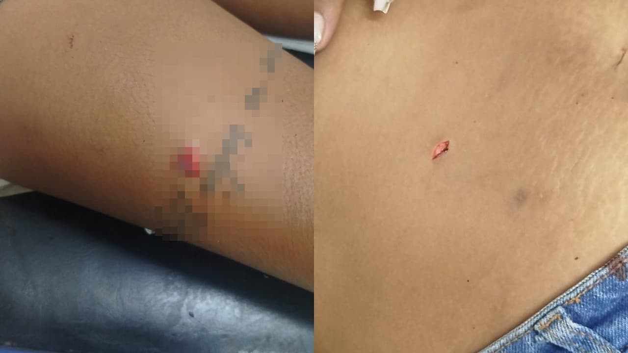 Briga por ciúmes marcada pelo celular termina com duas mulheres esfaqueadas nas Lages, em João Pinheiro